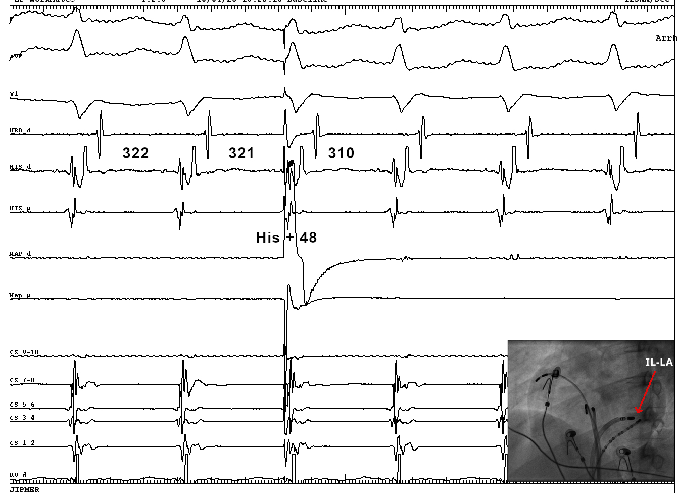 32-left lateral repeated.JPG